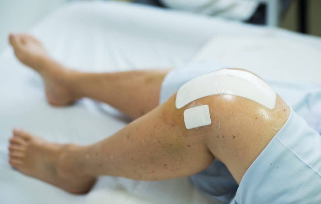 How Long Are You In Hospital After Knee Replacement ...