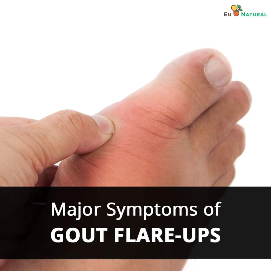 How Long Can A Gout Flare Up Last