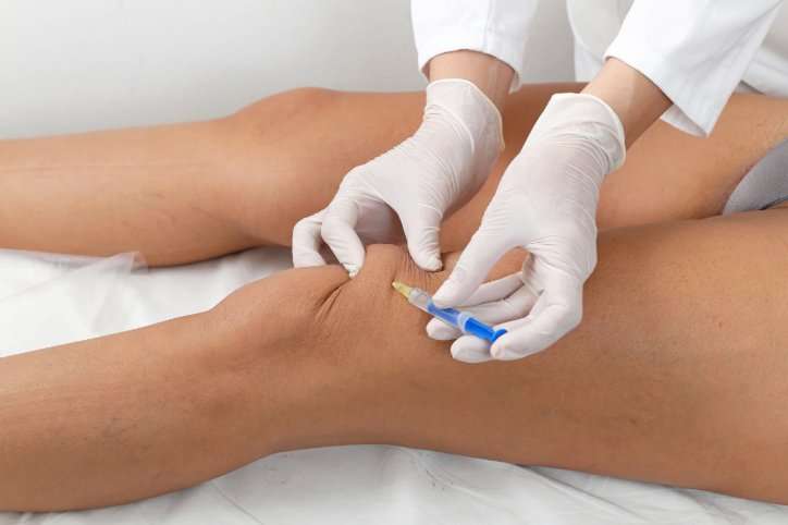 How Long Does a Knee Injection for Arthritis Last ...