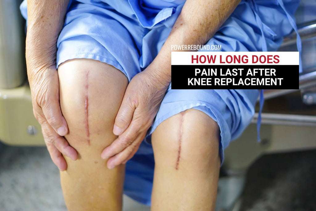 How Long Does Pain Last After Knee Replacement: What to Expect ...
