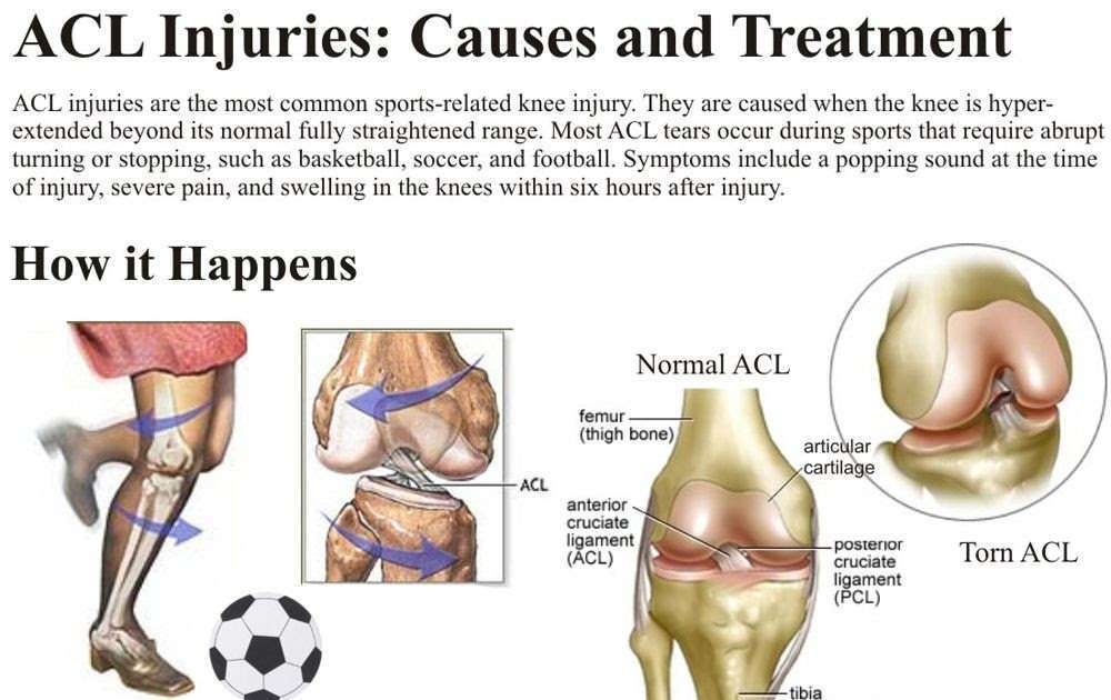 How Long Does Torn Knee Ligaments Take To Heal