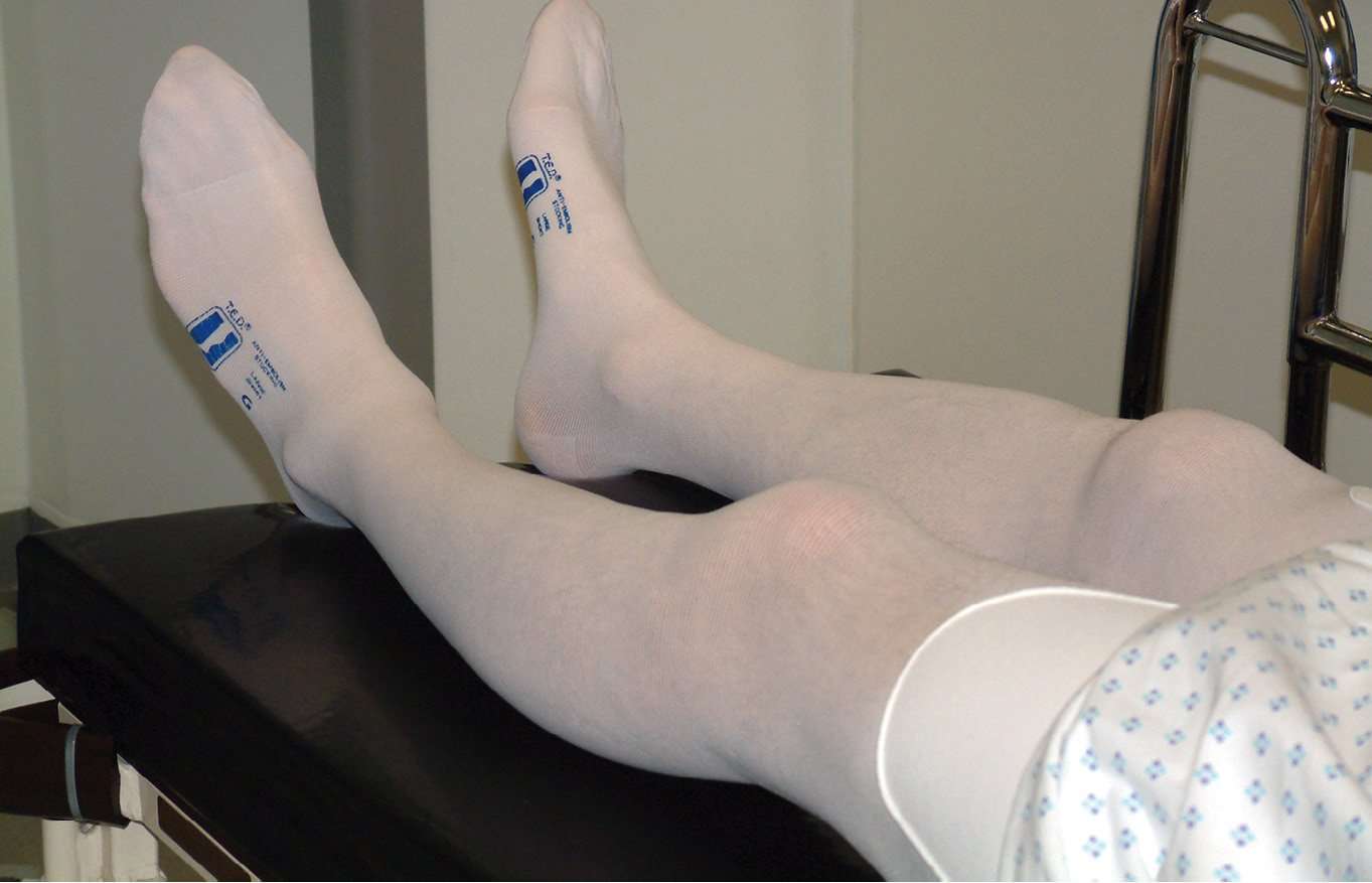 How Long To Wear Ted Stockings After Hip Surgery