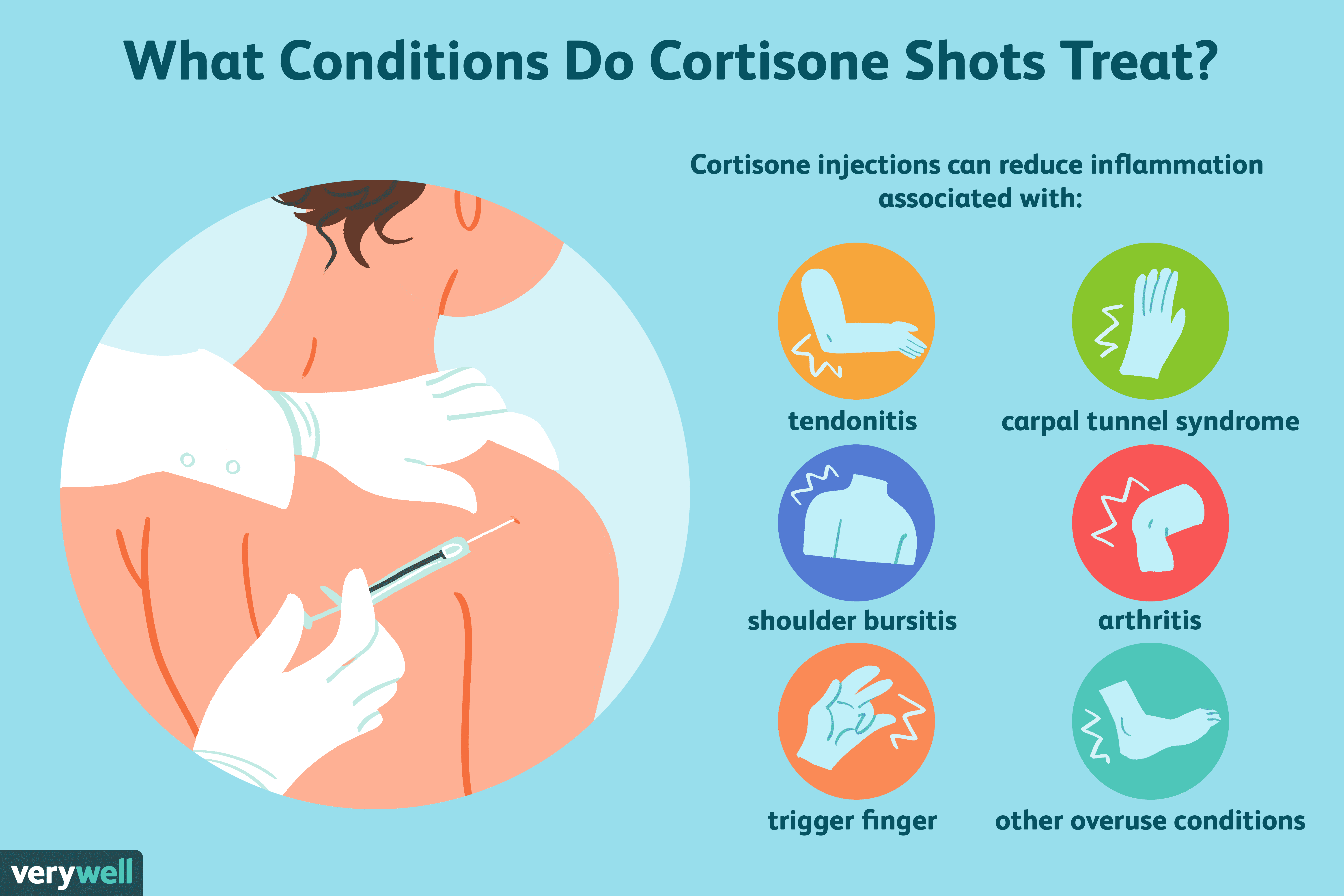 How Many Cortisone Shots Can You Have?