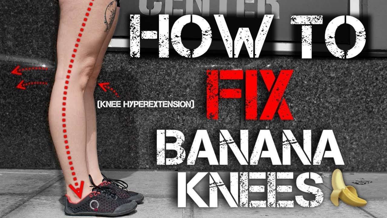 How to Fix Banana Knees (Knee Hyperextension)