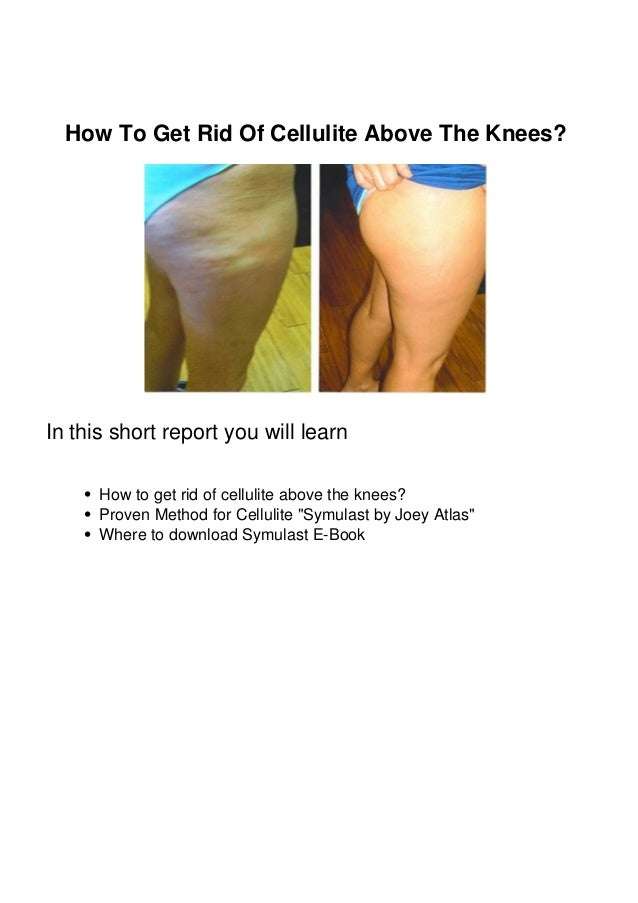 How To Get Rid Of Cellulite Above The Knees