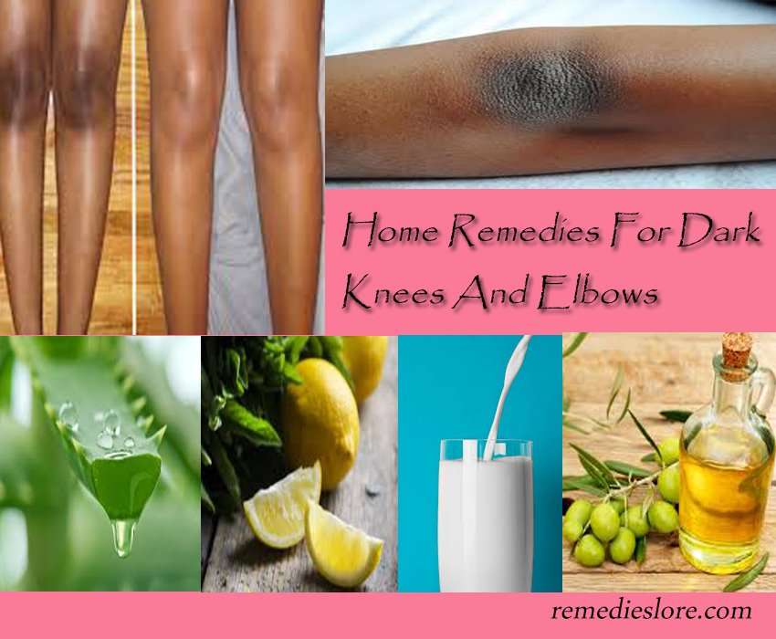 How to Get Rid of Dark Knees and Elbows