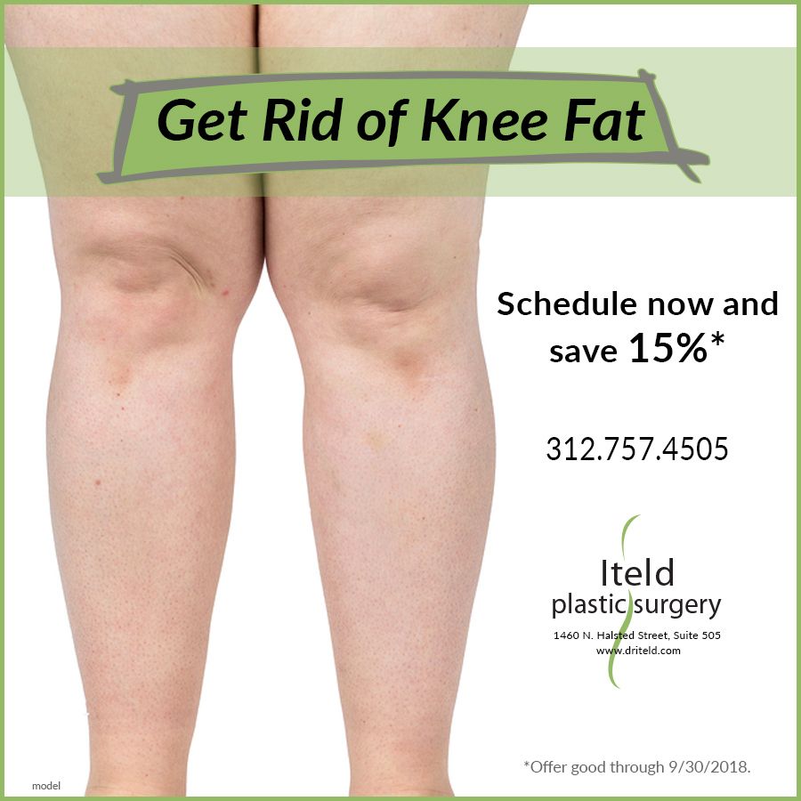 how to get rid of fat on knees