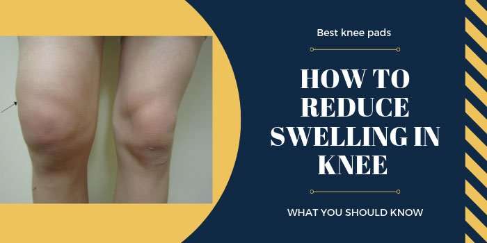 How To Reduce Swelling In Knee
