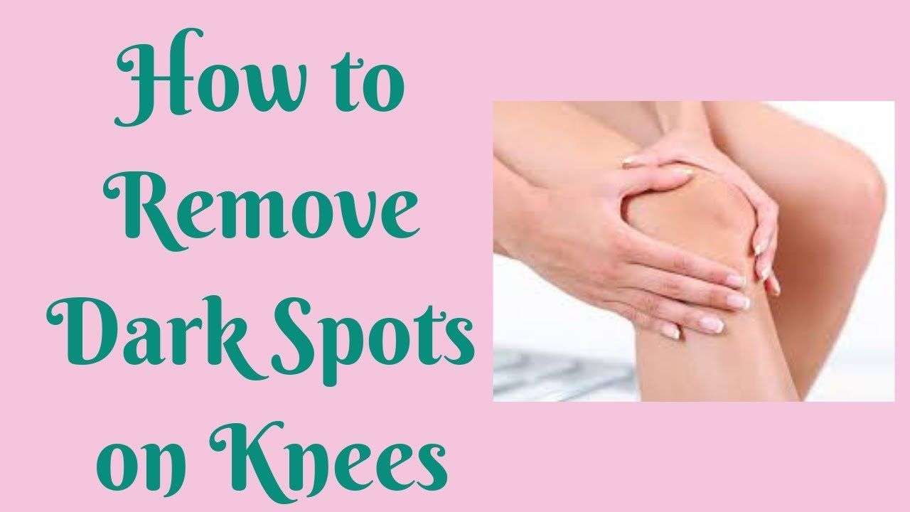 How to Remove Dark Spots on Knees