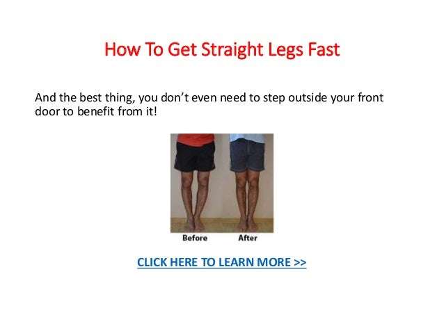How To Straighten Legs Knock Knees Without Surgery