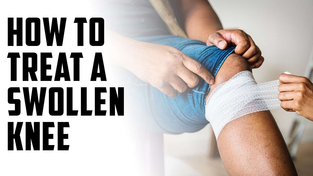 How to treat a swollen knee