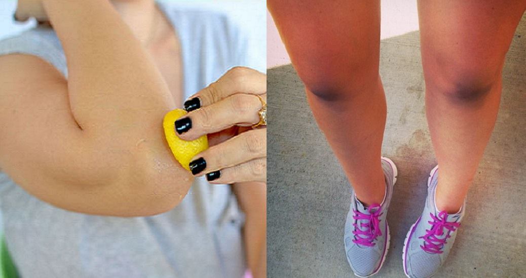 How To Whiten Dark Elbows, Underarms And Knees At Home Fast