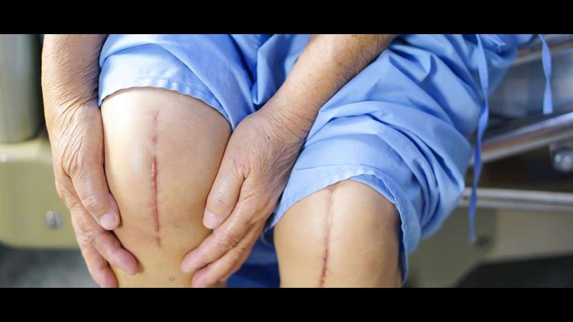How you can avoid knee replacement surgery