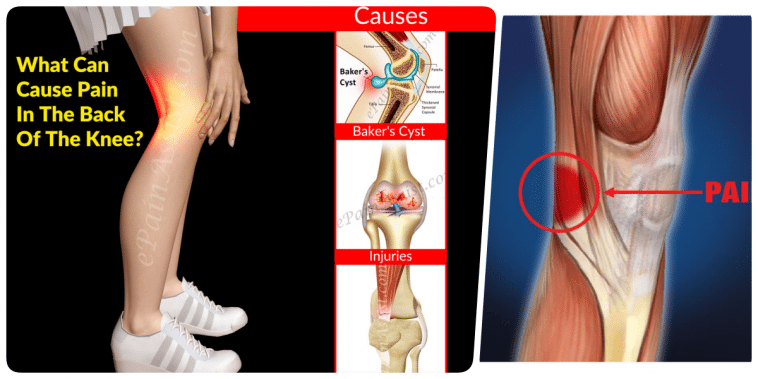 If you have pain behind knee, this is what you do