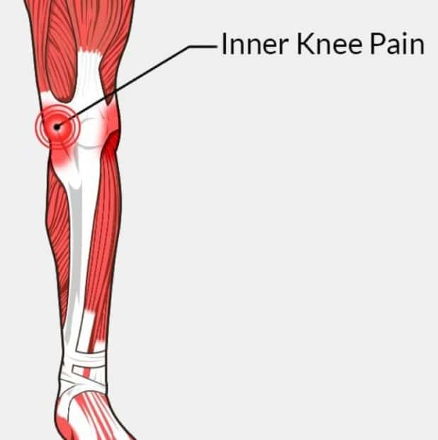 Interior Knee Pain And Swelling