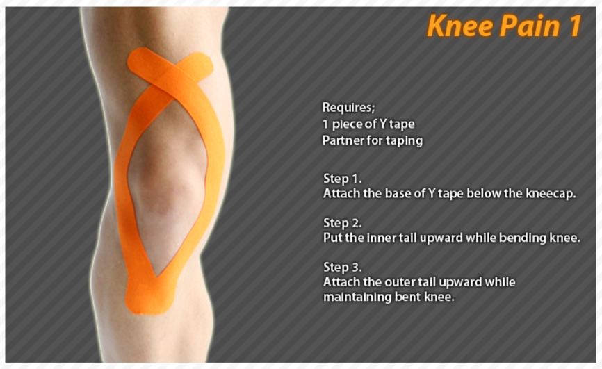 Kinesiology taping instructions for knee pain #ktape #knee ...