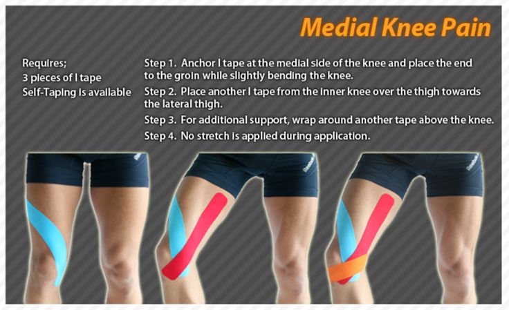 Kinesiology taping instructions for medial knee pain # ...