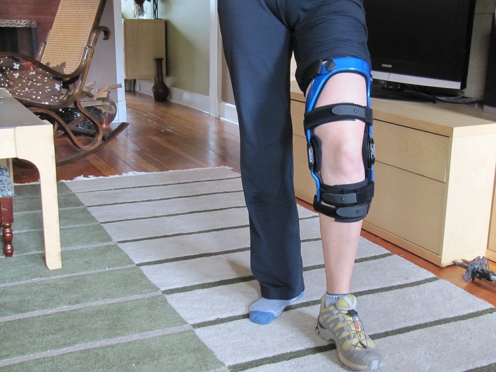 Knee â Torn Posterior Cruciate Ligament (PCL)