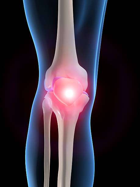 Knee Arthrosis Stock Photos, Pictures &  Royalty
