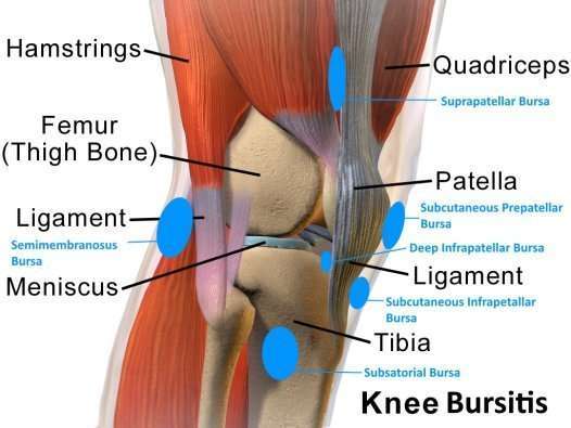Knee Bursitis in Runners