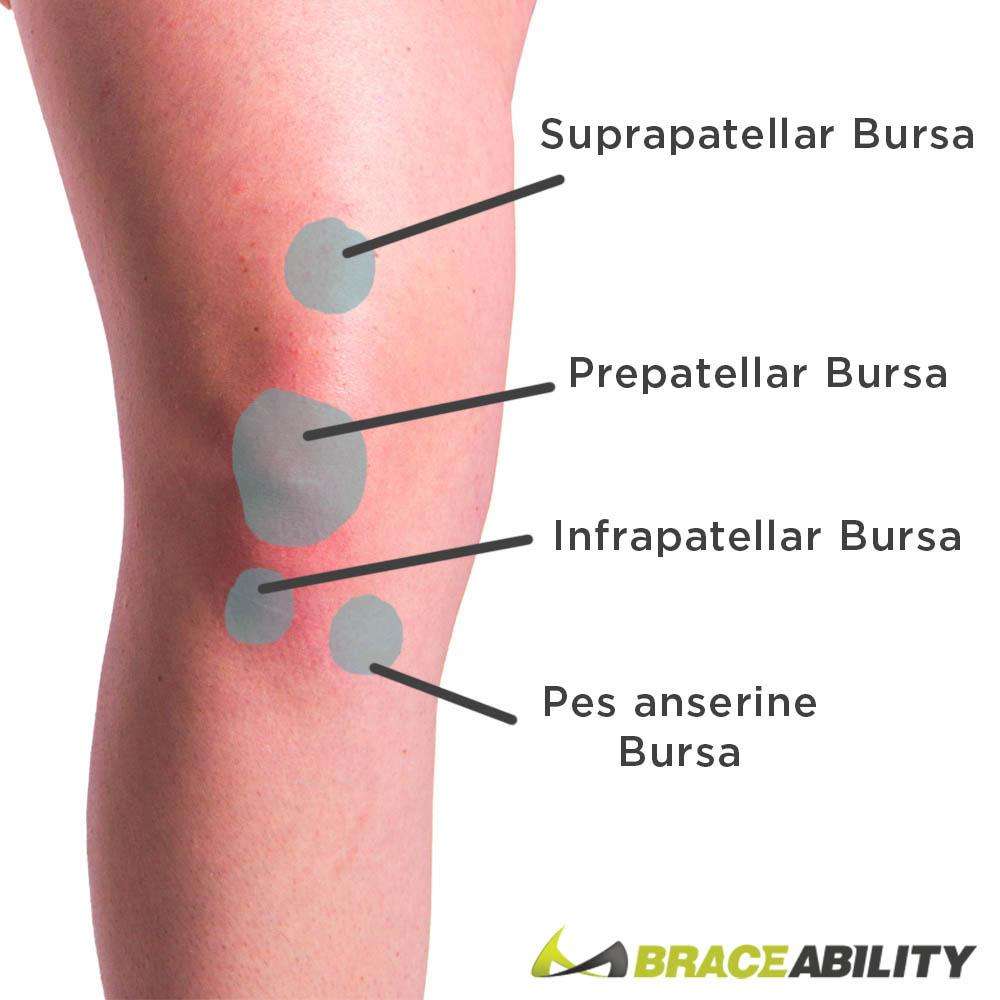 Knee Bursitis Treatment Brace for Inflammation &  Swelling
