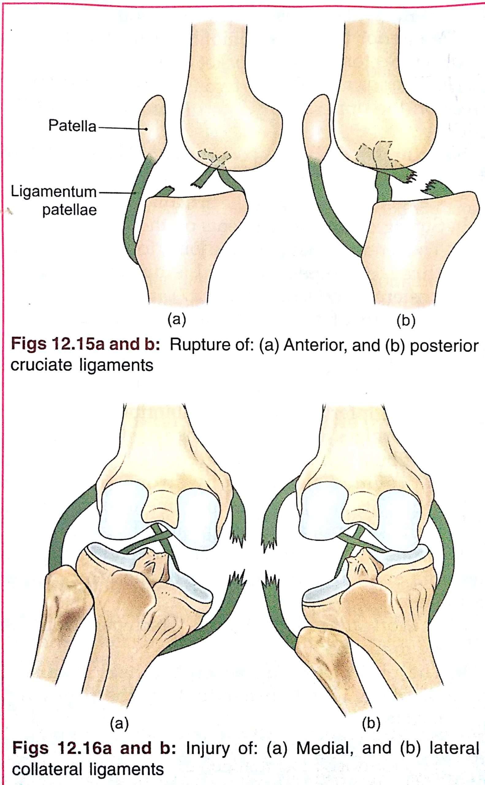 Knee Joint