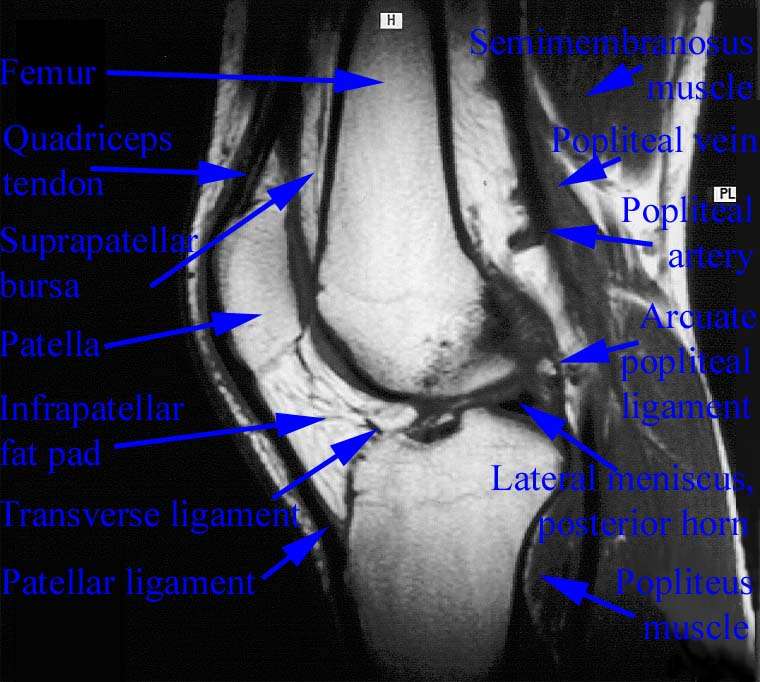 Knee MRI scan. Causes, symptoms, treatment Knee MRI scan