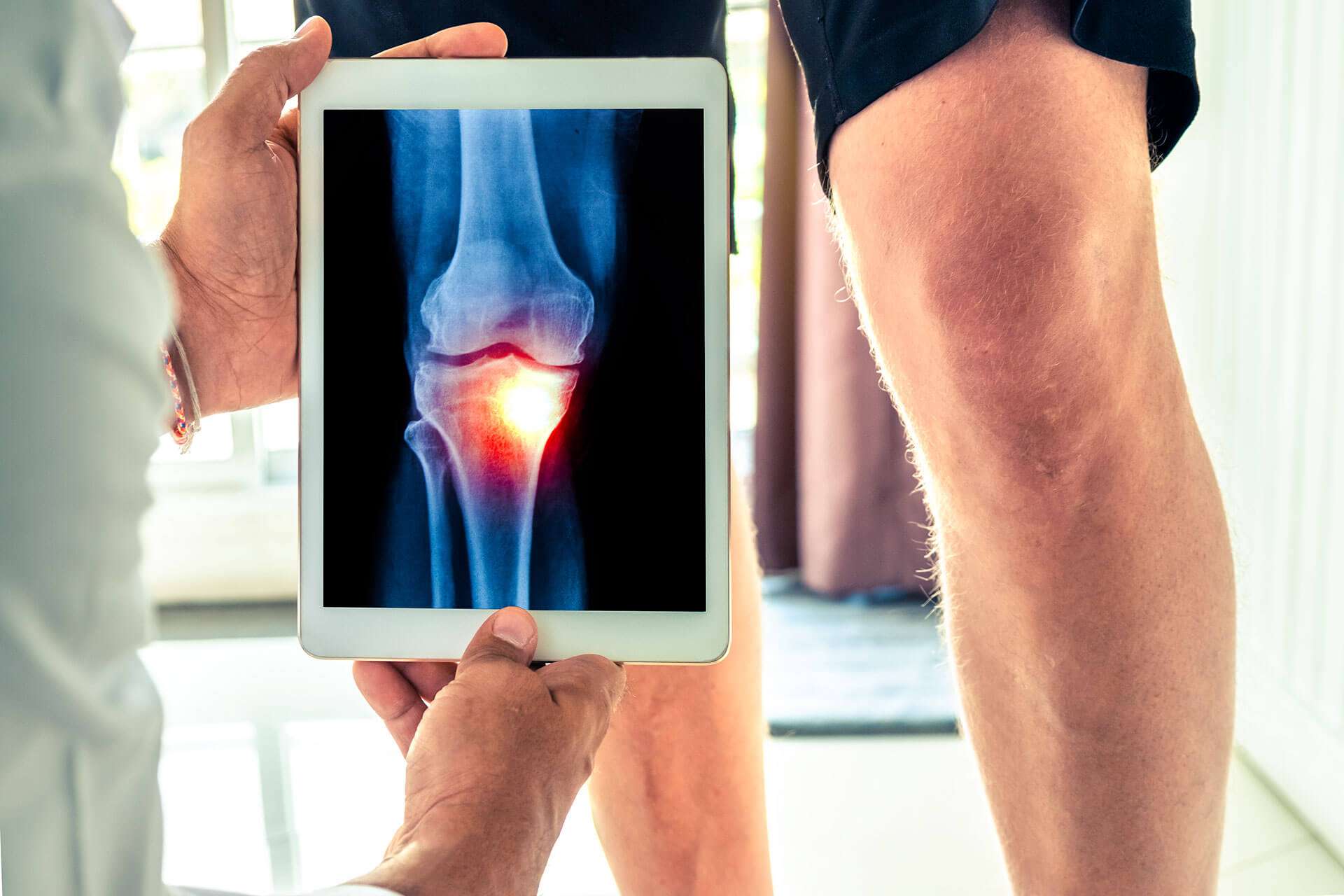 Knee Osteoarthritis: How (and Why) to Avoid Knee ...