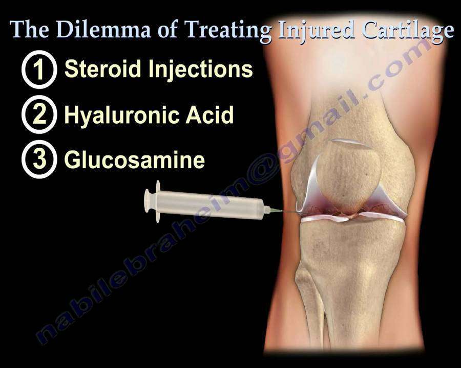 Knee pain ,arthritis and Injured Cartilage