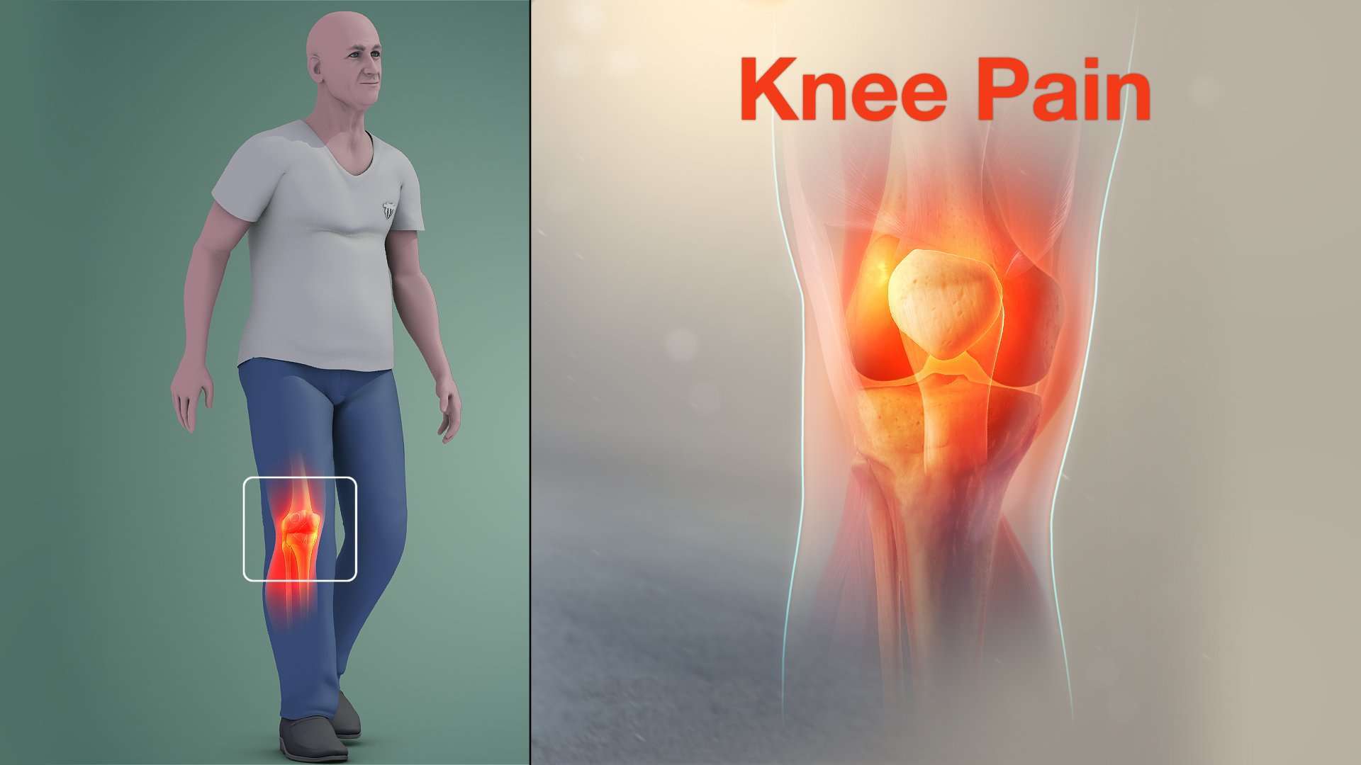 Knee Pain Caused By Damage In Knee Joint Shown Using ...