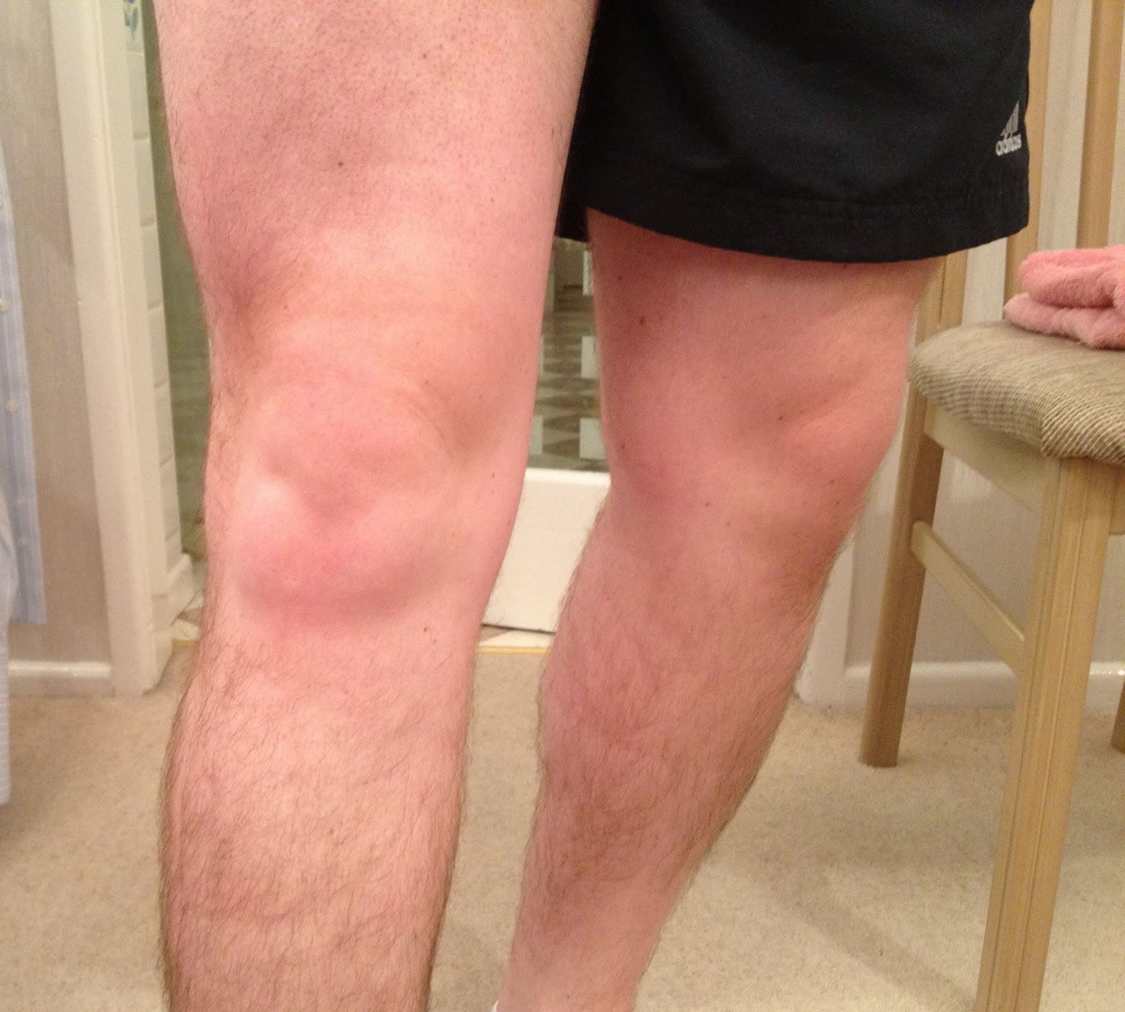 Knee Pain Cycling : andy