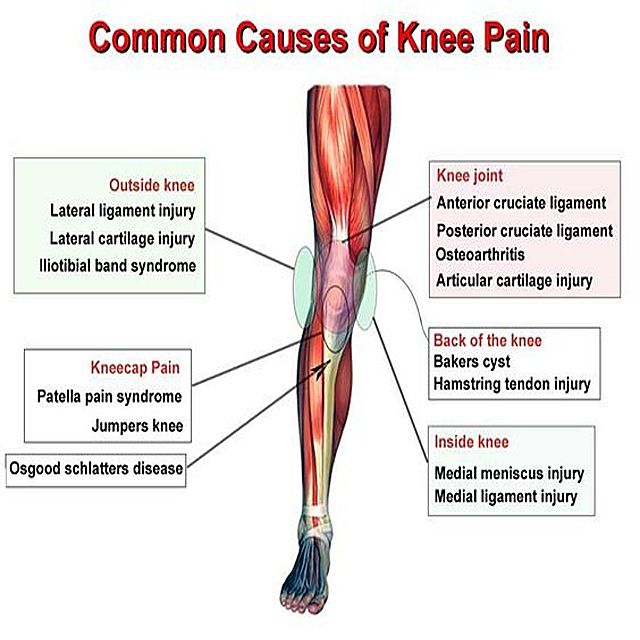 Knee Pain Overview Emedicinehealth