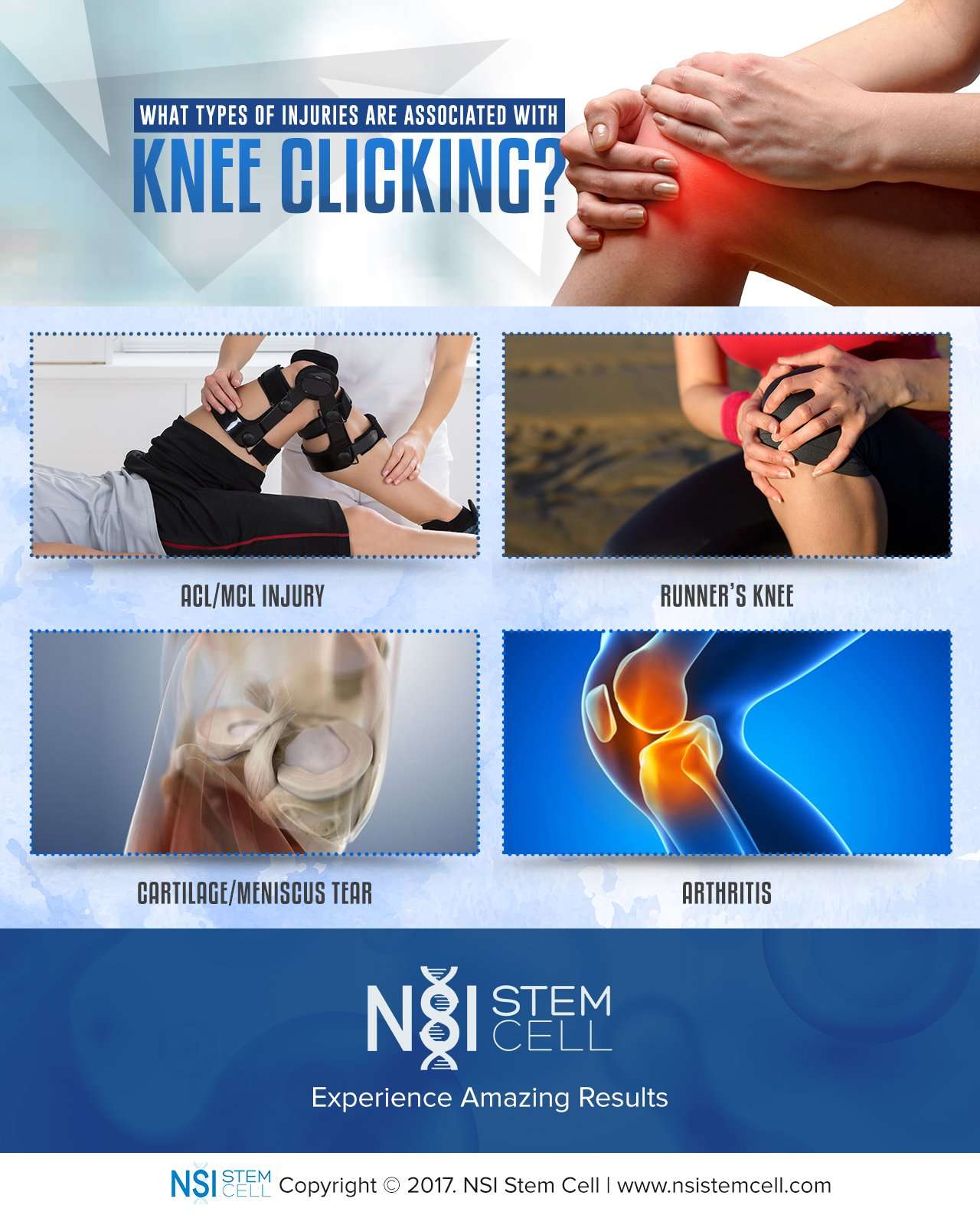 Knee Popping: Why is My Knee Clicking?  NSI Stem Cell