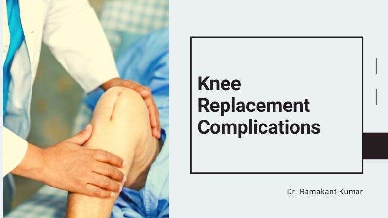 Knee Replacement Complications