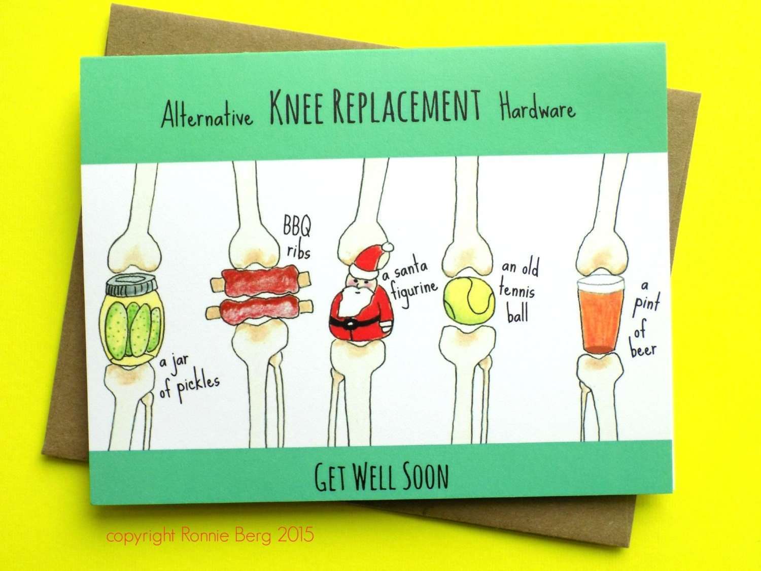 Knee Replacement Funny Get Well Card Knee Surgery by ...