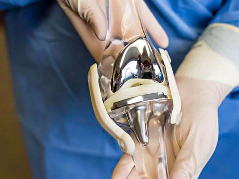 Knee Replacement Mexico