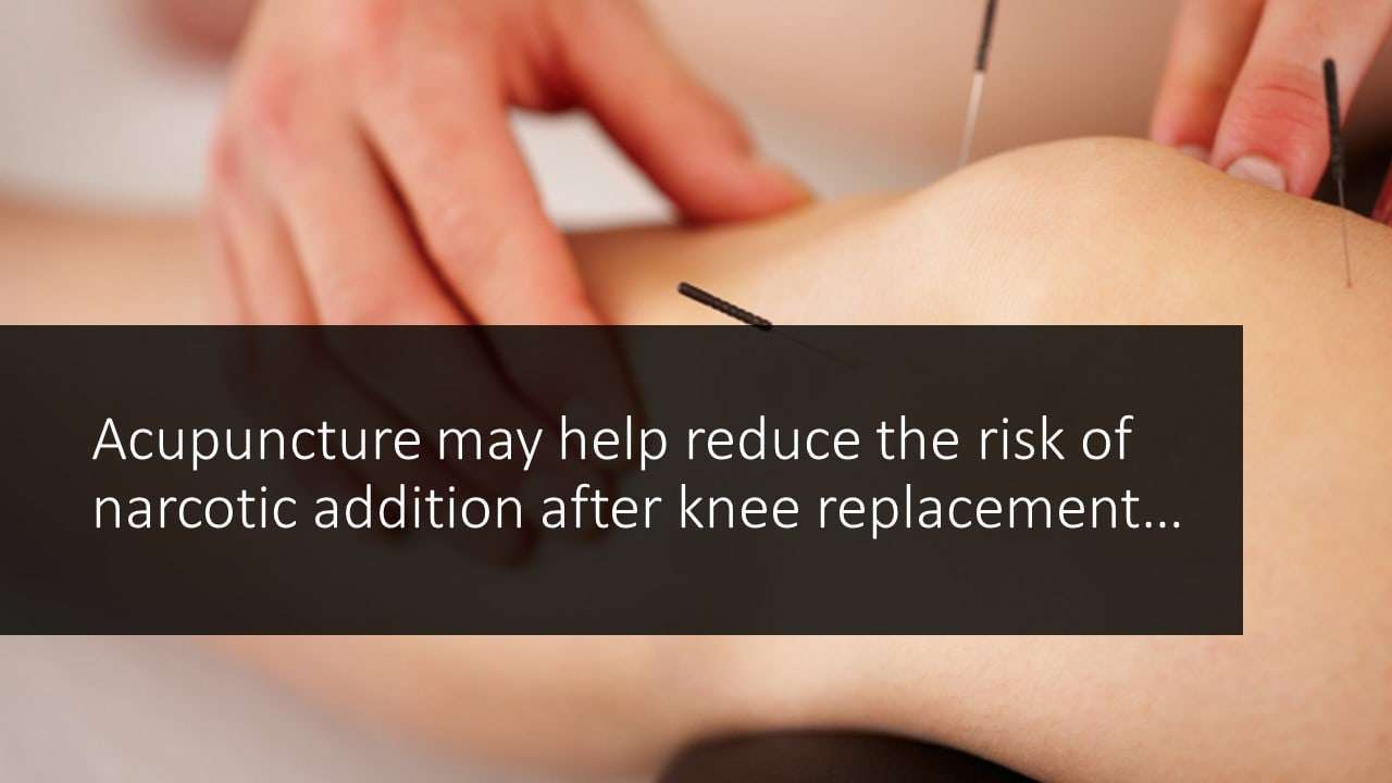 knee replacement opioid risk