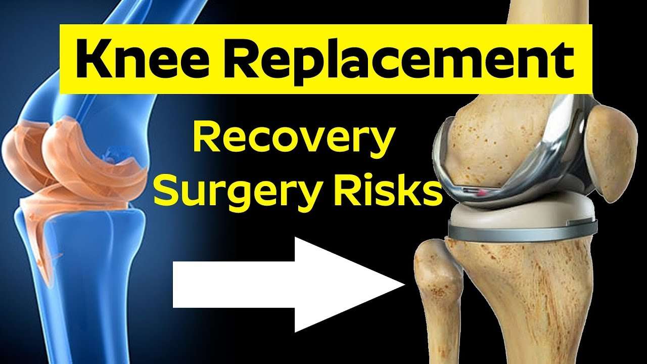 Knee Replacement Recovery &  Surgery Risks