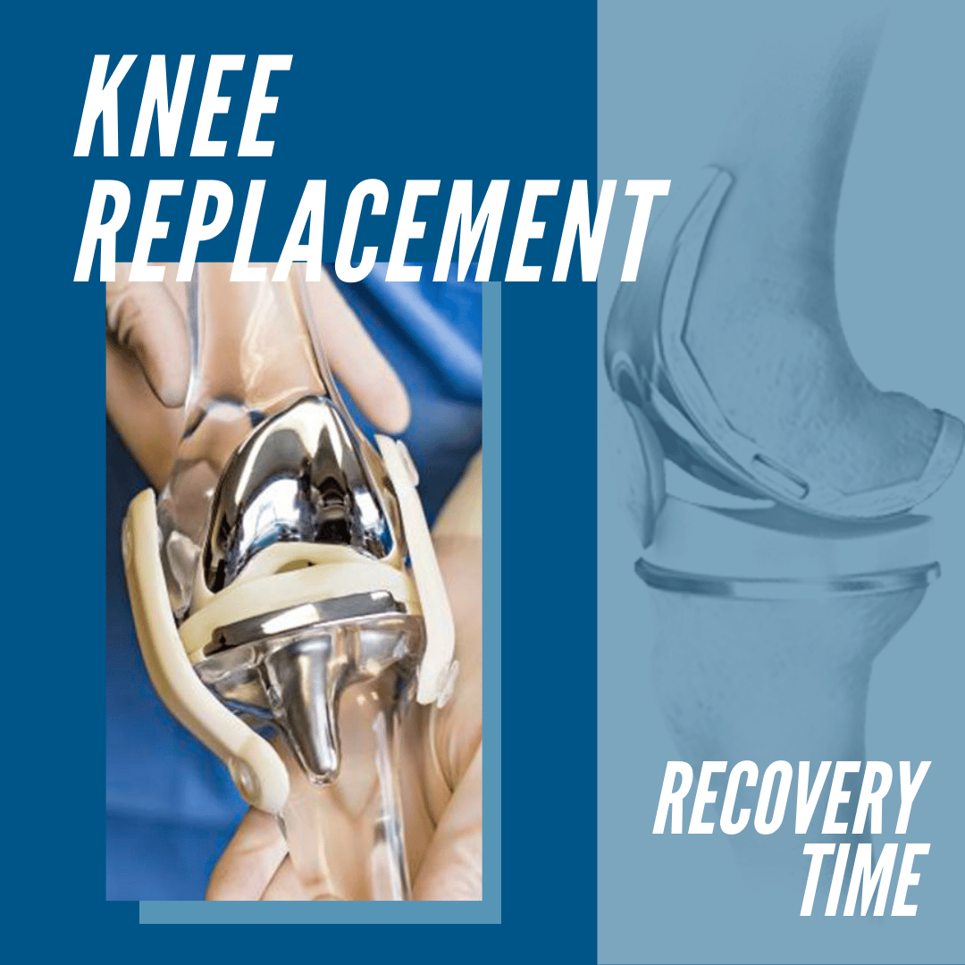 Knee Replacement Recovery Time