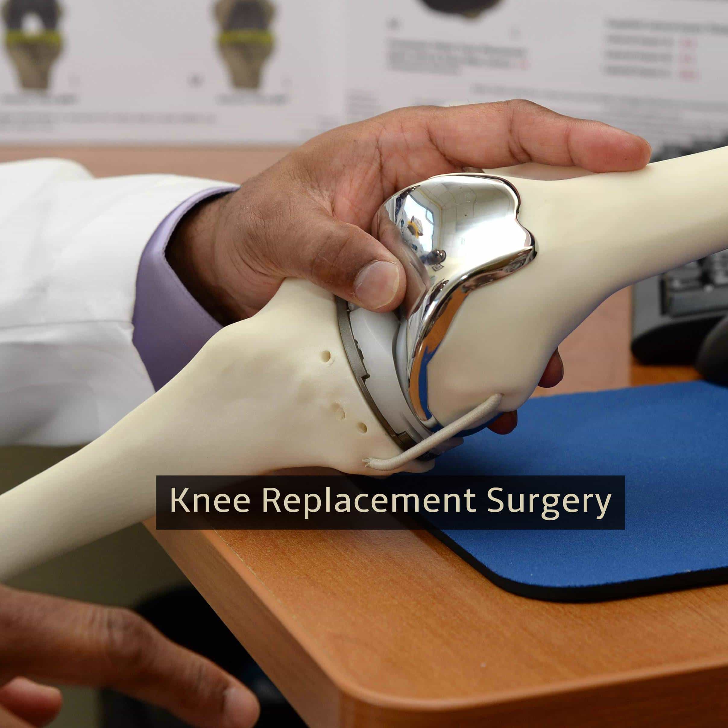 Knee Replacement Surgery â What to Expect During Recovery ...
