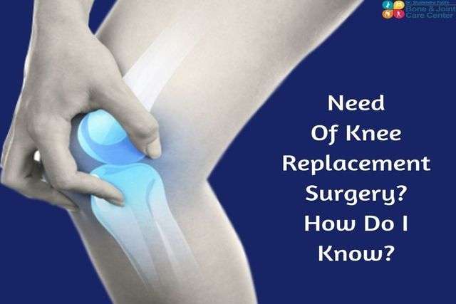 Knee Replacement Surgery Need? How Do I Know?