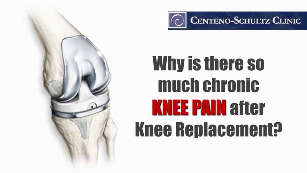 Knee Replacement &  The Pain Afterwards