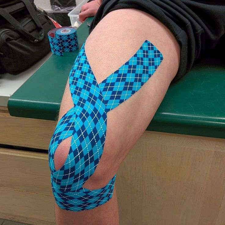 Kt tape full knee application