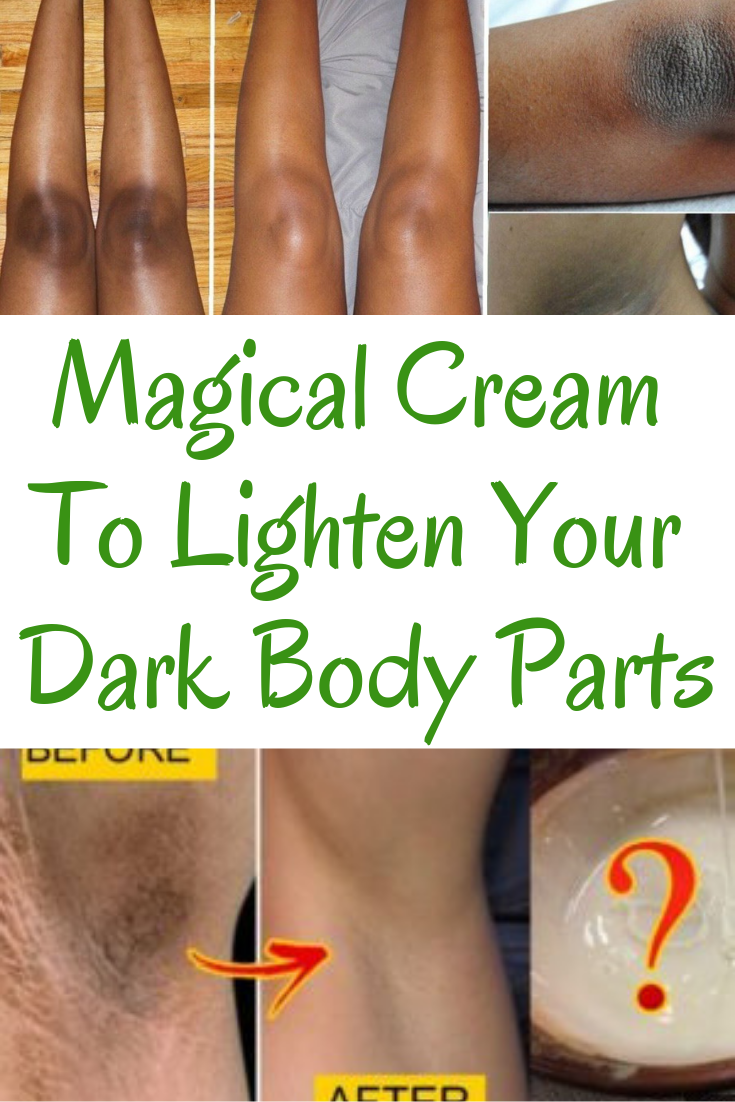 Learn how to lighten dark knees and elbows, also lighten your dark ...