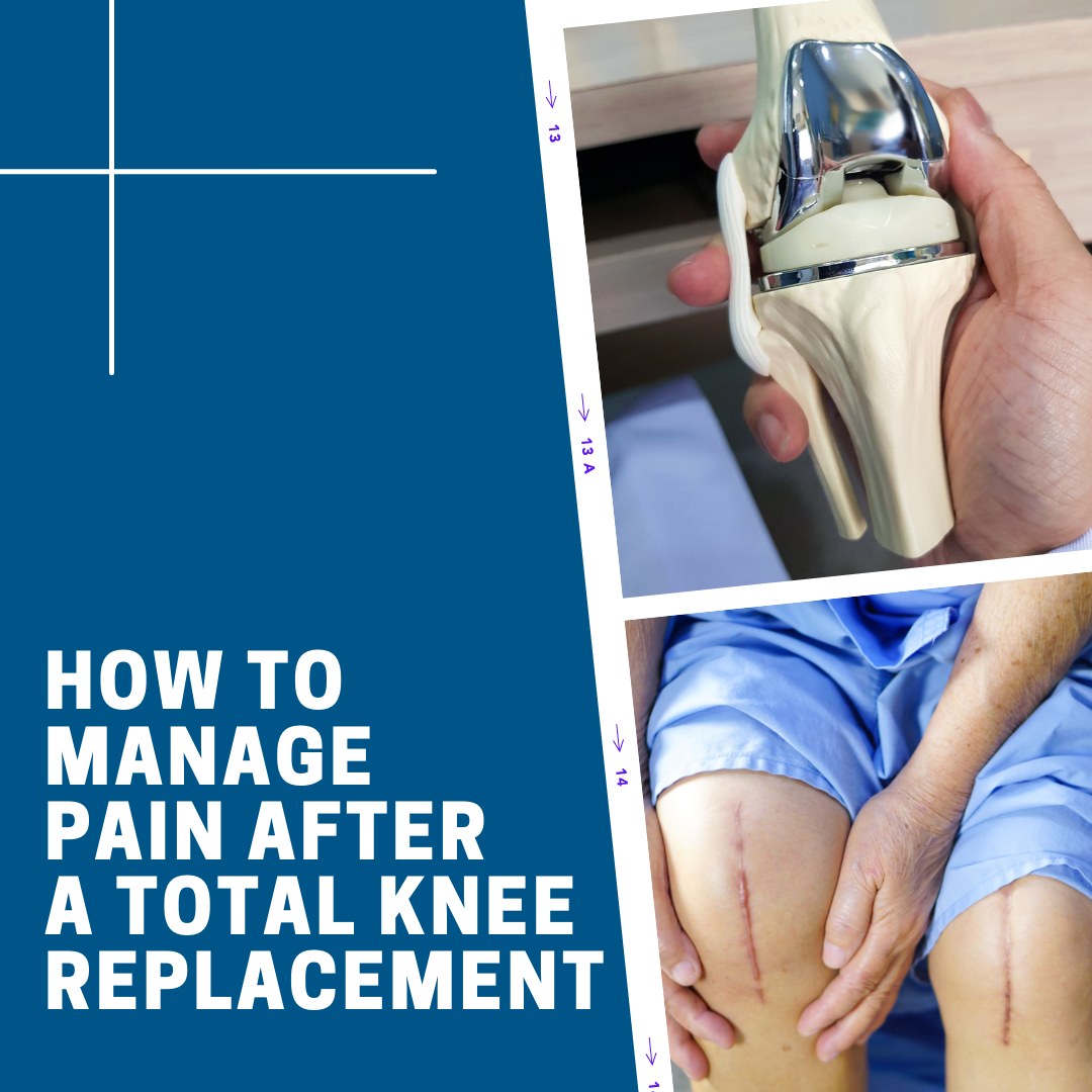 Managing Pain After Total Knee Replacement