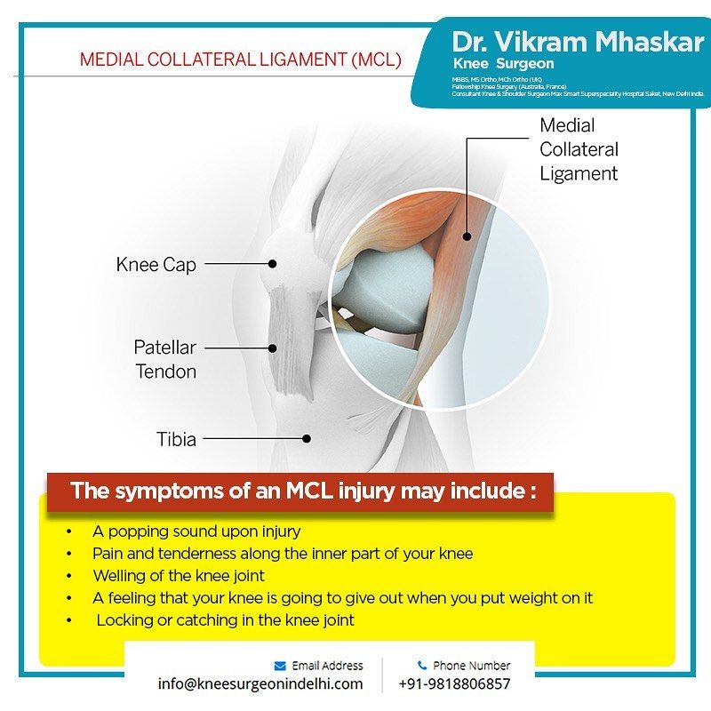 MCL Injury Symptoms.
