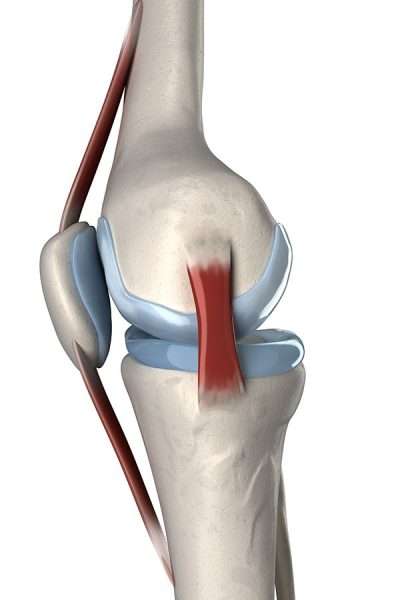 Medial Collateral Ligament injury