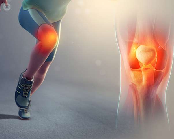 Most common knee pain  Patellofemoral Pain Syndrome (PFPS ...