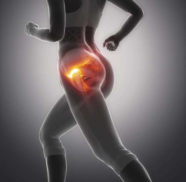 Muscles In Hip Area : Usually, hip pain is radicular (radiating) pain ...
