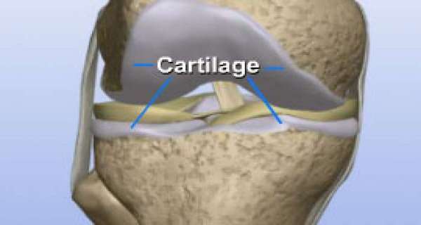 Naturally Restore Knee Cartilages